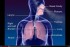 Respiration 3D Medical Animation